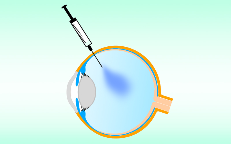 IVOMGRAFIK IVOMGRAFIK